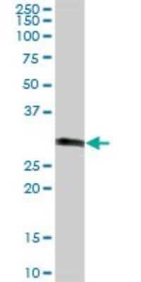 Western Blot: CBR3 Antibody [H00000874-B01P] - Analysis of CBR3 expression in human colon.
