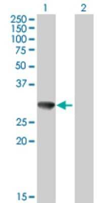 Western Blot: CBR3 Antibody [H00000874-B01P] - Analysis of CBR3 expression in transfected 293T cell line by CBR3 polyclonal antibody.  Lane 1: CBR3 transfected lysate(30.47 KDa). Lane 2: Non-transfected lysate.
