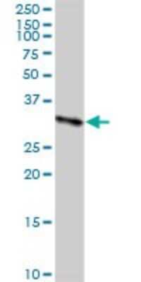 Western Blot: CBR3 Antibody [H00000874-D01P] - Analysis of CBR3 expression in human kidney.