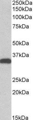 Western Blot: CBR3 Antibody [NB300-858] - (0.5ug/ml) staining of HEK293 lysate (35ug protein in RIPA buffer). Primary incubation was 1 hour. Detected by chemiluminescence.