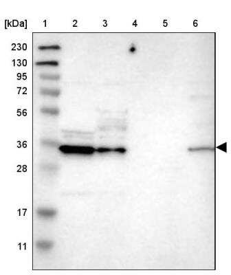 Western Blot: CBR3 Antibody [NBP1-87065] - Lane 1: Marker  [kDa] 230, 130, 95, 72, 56, 36, 28, 17, 11.  Lane 2: Human cell line RT-4.  Lane 3: Human cell line U-251MG sp.  Lane 4: Human plasma (IgG/HSA depleted).  Lane 5: Human liver tissue.  Lane 6: Human tonsil tissue