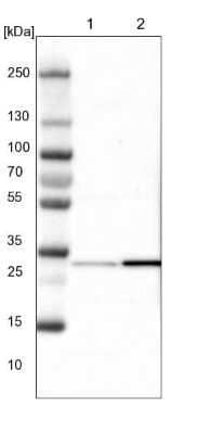 Western Blot: CBR3 Antibody [NBP1-87065] - Lane 1: NIH-3T3 cell lysate (Mouse embryonic fibroblast cells). Lane 2: NBT-II cell lysate (Rat Wistar bladder tumor cells).