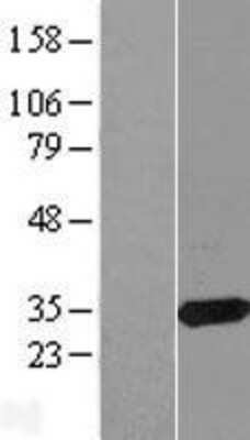 Western Blot: CBR3 Overexpression Lysate (Adult Normal) [NBL1-08742] Left-Empty vector transfected control cell lysate (HEK293 cell lysate); Right -Over-expression Lysate for CBR3.