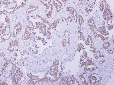 Immunohistochemistry-Paraffin CBR4 Antibody