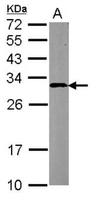 Western Blot CBR4 Antibody