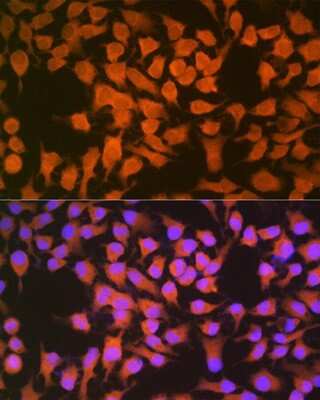 Immunocytochemistry/Immunofluorescence: CBS Antibody (1R2E9) [NBP3-15413] - Immunofluorescence analysis of HeLa cells using CBS Rabbit mAb (NBP3-15413) at dilution of 1:100 (40x lens). Blue: DAPI for nuclear staining.