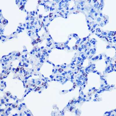 Immunohistochemistry-Paraffin: CBS Antibody (1R2E9) [NBP3-15413] - Immunohistochemistry of paraffin-embedded rat lung using CBS Rabbit mAb (NBP3-15413) at dilution of 1:100 (40x lens).Perform microwave antigen retrieval with 10 mM PBS buffer pH 7.2 before commencing with IHC staining protocol.