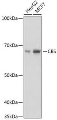 Western Blot: CBS Antibody (1R2E9) [NBP3-15413] - Western blot analysis of extracts of various cell lines, using CBS Rabbit mAb (NBP3-15413) at 1:1000 dilution. Secondary antibody: HRP Goat Anti-Rabbit IgG (H+L) at 1:10000 dilution. Lysates/proteins: 25ug per lane. Blocking buffer: 3% nonfat dry milk in TBST. Detection: ECL Basic Kit. Exposure time: 1s.