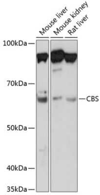 Western Blot: CBS Antibody (1R2E9) [NBP3-15413] - Western blot analysis of extracts of various cell lines, using CBS Rabbit mAb (NBP3-15413) at 1:1000 dilution. Secondary antibody: HRP Goat Anti-Rabbit IgG (H+L) at 1:10000 dilution. Lysates/proteins: 25ug per lane. Blocking buffer: 3% nonfat dry milk in TBST. Detection: ECL Basic Kit. Exposure time: 30s.