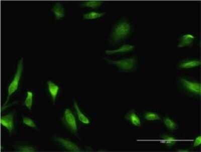 Immunocytochemistry/Immunofluorescence: CBS Antibody (3D10) [H00000875-M02] - Analysis of monoclonal antibody to CBS on HeLa cell . Antibody concentration 10 ug/ml.