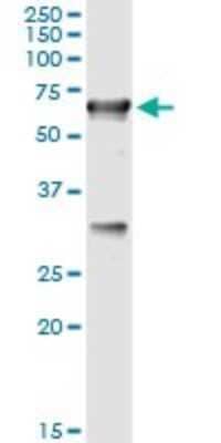 Immunoprecipitation: CBS Antibody (3D10) [H00000875-M02] - Analysis of CBS transfected lysate using anti-CBS monoclonal antibody and Protein A Magnetic Bead, and immunoblotted with CBS MaxPab rabbit polyclonal antibody.