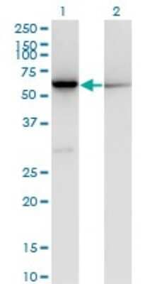 Western Blot: CBS Antibody (3D10) [H00000875-M02] - Analysis of CBS expression in transfected 293T cell line by CBS monoclonal antibody (M02), clone 3D10.Lane 1: CBS transfected lysate (Predicted MW: 60.6 KDa).Lane 2: Non-transfected lysate.