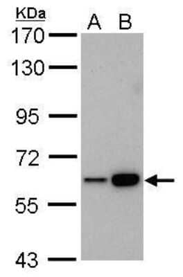 Western Blot: CBS Antibody (519) [NBP2-43604] - Analysis of A. 30 ug Raji whole cell lysate/extract B. 30 ug K562 whole cell lysate/extract 7.5 % SDS-PAGE CBS antibody [519] dilution: 1:1000