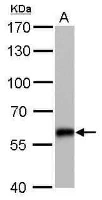 Western Blot: CBS Antibody (519) [NBP2-43604] - Analysis of A. 50 ug mouse liver lysate/extract 7.5 % SDS-PAGE CBS antibody [519] dilution: 1:2000.