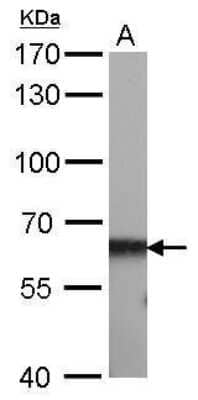 Western Blot: CBS Antibody (519) [NBP2-43604] - Analysis of A. 50 ug rat liver lysate/extract 7.5 % SDS-PAGE CBS antibody [519] dilution: 1:1000