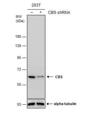 <b>Genetic Strategies Validation. </b>Knockdown Validated: CBS Antibody (519) [NBP2-43604] - Non-transfected (-) and transfected (+) 293T whole cell extracts (30 ug) were separated by 7.5% SDS-PAGE, and the membrane was blotted with CBS antibody [GT519].