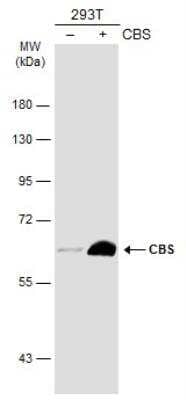 Western Blot: CBS Antibody (519) [NBP2-43604] - Non-transfected (-) and transfected (+) 293T whole cell extracts (30 ug) were separated by 7.5% SDS-PAGE, and the membrane was blotted with CBS antibody (519) diluted at 1:1000. HRP-conjugated anti-mouse IgG antibody was used to detect the primary antibody.