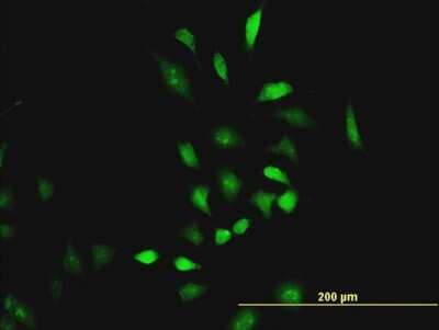 Immunocytochemistry/Immunofluorescence: CBS Antibody (5F7) [H00000875-M07] - Analysis of monoclonal antibody to CBS on HeLa cell. Antibody concentration 15 ug/ml