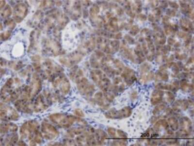 Immunohistochemistry-Paraffin: CBS Antibody (5F7) [H00000875-M07] - Analysis of monoclonal antibody to CBS on formalin-fixed paraffin-embedded human pancreas. Antibody concentration 3 ug/ml