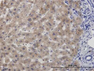 Immunohistochemistry-Paraffin: CBS Antibody (6A9) [H00000875-M06] - Analysis of monoclonal antibody to CBS on formalin-fixed paraffin-embedded human liver. Antibody concentration 3 ug/ml