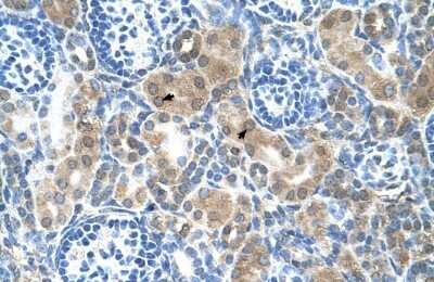 Immunohistochemistry-Paraffin: CBS Antibody [NBP1-52850] - Human Kidney tissue, Epithelial cells of renal tubule (Indicated with Arrows) 4-8 ug/ml.