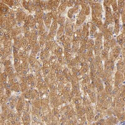 Immunohistochemistry-Paraffin: CBS Antibody [NBP1-83255] - Staining of human liver shows moderate cytoplasmic positivity in hepatocytes.