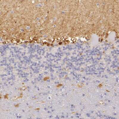 Immunohistochemistry-Paraffin: CBS Antibody [NBP1-83255] - Staining of human cerebellum shows moderate cytoplasmic positivity in a subset of cells in granular layer, as well as in neuropil of molecular layer.