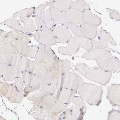 Immunohistochemistry-Paraffin: CBS Antibody [NBP1-83255] - Staining of human skeletal muscle shows no positivity in striated muscle fibers as expected.