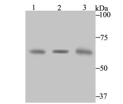 Western Blot: CBS Antibody (JE40-99) [NBP2-76982] - Western blot analysis of CBS on different lysates using anti-CBS antibody at 1/1,000 dilution.Positive control:Lane 1: 293 Lane 2: 293Lane 3: human liver tissue
