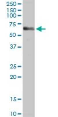 Western Blot: CBS Antibody [H00000875-D01P] - Analysis of CBS expression in human pancreas.
