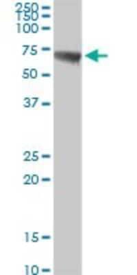 Western Blot: CBS Antibody [H00000875-D01P] - Analysis of CBS expression in mouse kidney.