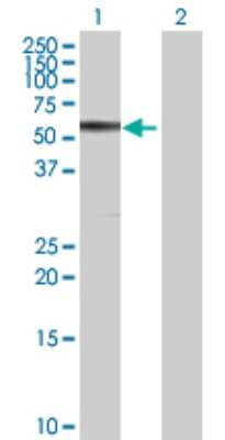Western Blot: CBS Antibody [H00000875-D01P] - Analysis of CBS expression in transfected 293T cell line by CBS polyclonal antibody.Lane 1: CBS transfected lysate(60.60 KDa).Lane 2: Non-transfected lysate.
