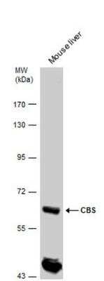 Western Blot: CBS Antibody [NBP1-33518] - Mouse tissue extracts (50 ug) was separated by 7.5% SDS-PAGE, and the membrane was blotted with CBS antibody  diluted by 1:5000. The HRP-conjugated anti-rabbit IgG antibody (NBP2-19301) was used to detect the primary antibody.