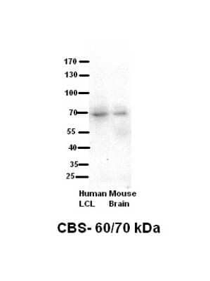 Western Blot: CBS Antibody [NBP1-52850] - Human kidney lysate, concentration 4-8ug/ml.