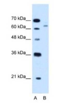 Western Blot: CBS Antibody [NBP1-52850] - HepG2 cell lysate, concentration 1.25 ug/ml.