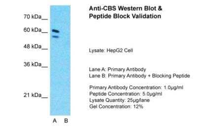 Western Blot: CBS Antibody [NBP1-52850] - HepG2 Lane A: Primary Antibody Lane B: Primary Antibody + Blocking Peptide Primary Antibody Concentration: 1 ug/ml Peptide Concentration: 5 ug/ml lysate Quantity: 25ug/ Lane/ Lane Gel Concentration: 0.12.