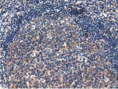Immunohistochemistry-Paraffin: CBWD1 Antibody (4D4) [NBP2-02931] - Staining of paraffin-embedded Human lymph node tissue using anti-CBWD1 mouse monoclonal antibody.