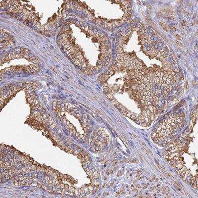 Immunohistochemistry: CBWD1 Antibody [NBP2-46683] - Staining of human prostate shows strong cytoplasmic and membranous positivity in glandular cells.