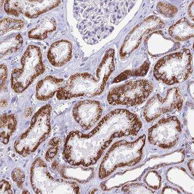 Immunohistochemistry: CBWD1 Antibody [NBP2-46685] - Staining of human kidney shows strong cytoplasmic positivity in cells in tubules.