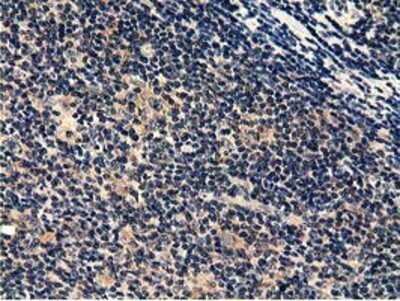 Immunohistochemistry: CBWD1 Antibody (OTI4D4) - Azide and BSA Free [NBP2-72027] - Staining of paraffin-embedded Human lymphoma tissue using anti-CBWD1 mouse monoclonal antibody.