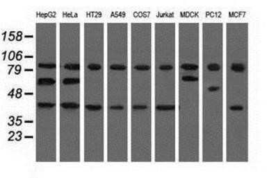 Western Blot: CBWD1 Antibody (OTI4D4) - Azide and BSA Free [NBP2-72027] - Analysis of extracts (35ug) from 9 different cell lines by using anti-CBWD1 monoclonal antibody.
