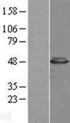 Western Blot: CBWD1 Overexpression Lysate (Adult Normal) [NBL1-08745] Left-Empty vector transfected control cell lysate (HEK293 cell lysate); Right -Over-expression Lysate for CBWD1.