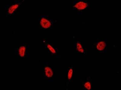 Immunocytochemistry/Immunofluorescence: CBX1 Antibody [NBP2-98755] - Immunofluorescence staining of CBX1 in HeLa cells. Cells were fixed with 4% PFA, permeabilzed with 0.3% Triton X-100 in PBS, blocked with 10% serum, and incubated with rabbit anti-human CBX1 polyclonal antibody (dilution ratio 1:1000) at 4C overnight.