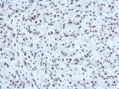 Immunohistochemistry-Paraffin: CBX1 Antibody [NBP2-14899] - Paraffin-embedded C2C12 xenograft, using antibody at 1:500 dilution.