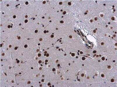 Immunohistochemistry-Paraffin: CBX1 Antibody [NBP2-14899] - CBX1 antibody detects CBX1 protein at nucleus in mouse brain by immunohistochemical analysis. Sample: Paraffin-embedded mouse brain diluted at 1:500.  