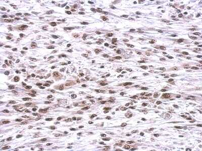 Immunohistochemistry-Paraffin: CBX1 Antibody [NBP2-14900] - Paraffin-embedded C2C12 xenograft; antibody dilution 1:500.