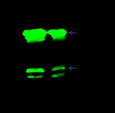Immunoprecipitation: CBX1 Antibody [NBP2-98755] - CBX1 was immunoprecipitated using: Lane A: 0.5 mg MCF-7 Whole Cell Lysate. Lane B: 0.5 mg 293T Whole Cell Lysate 2 ul anti-CBX1 rabbit polyclonal antibody and 60 ug of Immunomagnetic beads Protein G. Primary antibody: Anti-CBX1 rabbit polyclonal antibody, at 1:100 dilution. Secondary antibody: Dylight 800-labeled antibody to rabbit IgG (H+L), at 1:5000 dilution. Developed using the Odyssey technique. Performed under reducing conditions. Predicted band size: 21 kDa. Observed band size: 21 kDa
