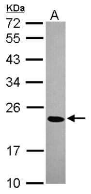 Western Blot: CBX1 Antibody [NBP2-14899] - Sample (30 ug of whole cell lysate) A: HeLa 12% SDS PAGE; antibody diluted at 1:1000.