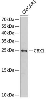 Western Blot: CBX1 Antibody [NBP2-92768] - Analysis of extracts of OVCAR-3 cells, using CBX1 at 1:1000 dilution.Secondary antibody: HRP Goat Anti-Rabbit IgG (H+L) at 1:10000 dilution.Lysates/proteins: 25ug per lane.Blocking buffer: 3% nonfat dry milk in TBST.Detection: ECL Basic Kit .Exposure time: 30s.