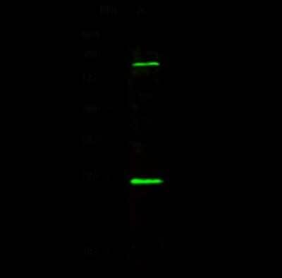 Western Blot: CBX1 Antibody [NBP2-98755] - Anti-CBX1 rabbit polyclonal antibody at 1:500 dilution. Lane A: MCF7 Whole Cell Lysate. Lysates/proteins at 30 ug per lane. Secondary Goat Anti-Rabbit IgG H&L (Dylight 800) at 1/10000 dilution. Developed using the Odyssey technique. Performed under reducing conditions. Predicted band size: 21 kDa. Observed band size: 23 kDa (We are unsure as to the identity of these extra bands).